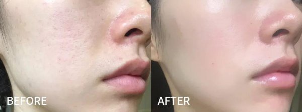 娇兰复原蜜好用吗